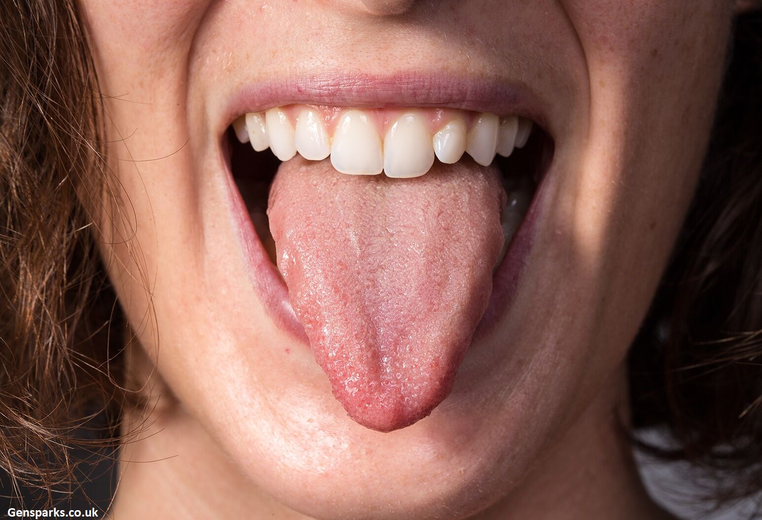 Why Is My Tongue Swollen and Sore on the Sides? Here's What's Actually Going On
